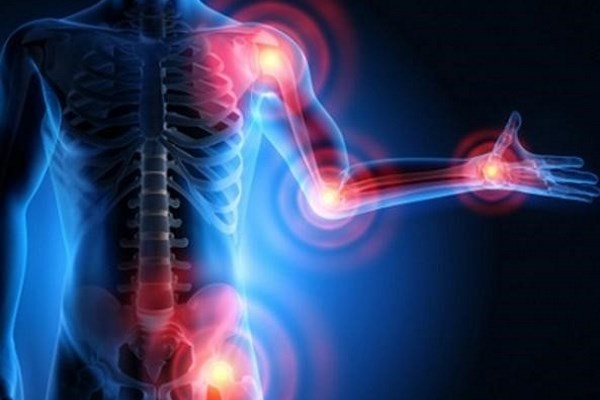 Dolori articolari: il sole è utile?